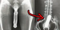 15 Strangest Things Discovered By X-Rays