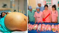 Mom gives birth to 11 babies then doctors realize one of them isn't a baby