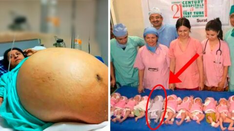 Mom gives birth to 11 babies then doctors realize one of them isn't a baby